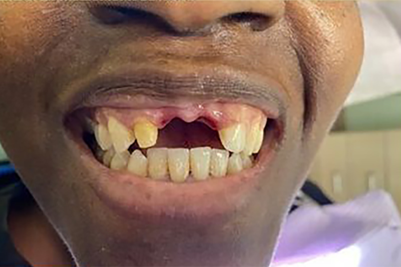 sugarland before and after dental treatment