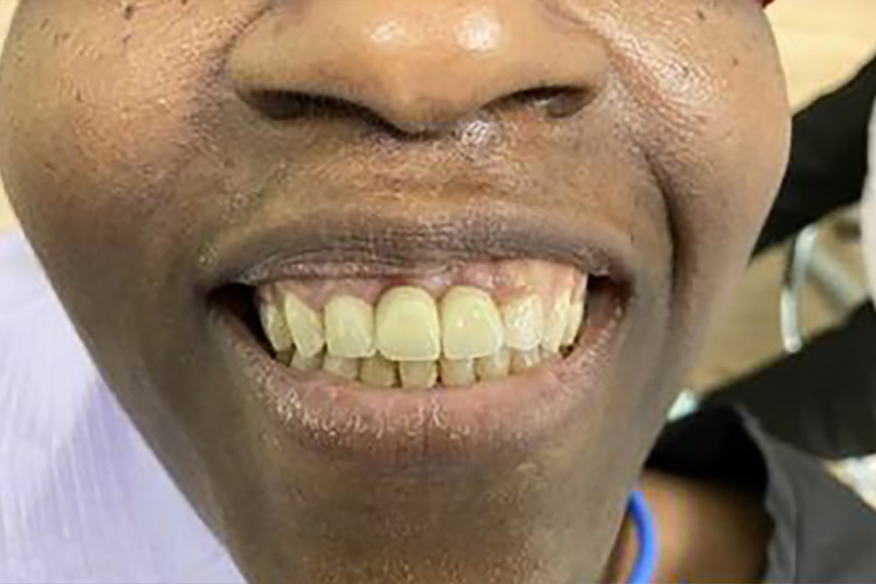 sugarland before and after dental treatment