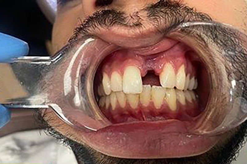 sugarland before and after dental treatment