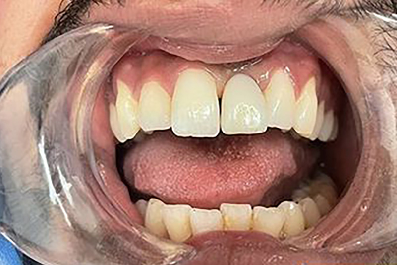 sugarland before and after dental treatment