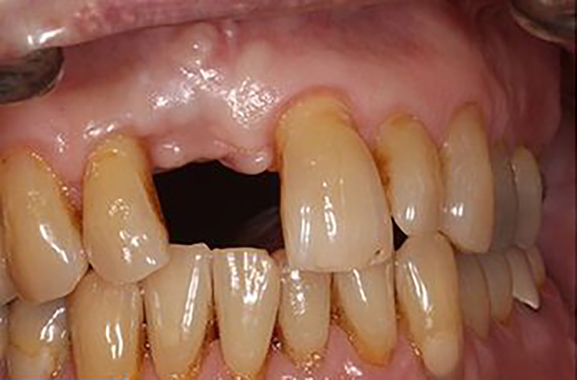 sugarland before and after dental treatment