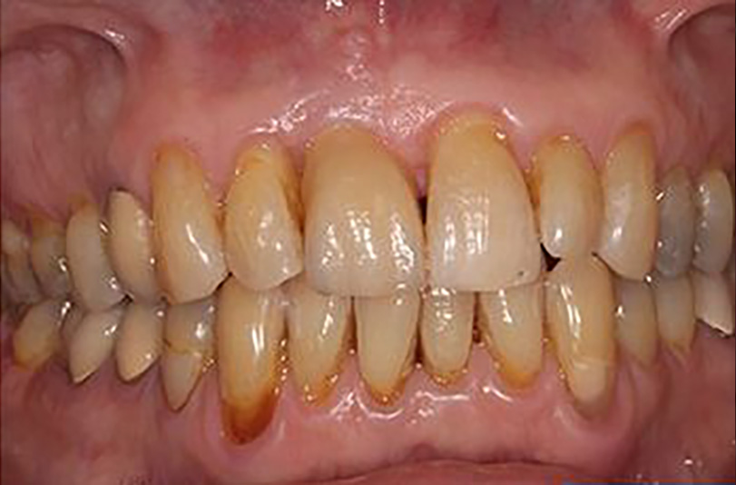 sugarland before and after dental treatment