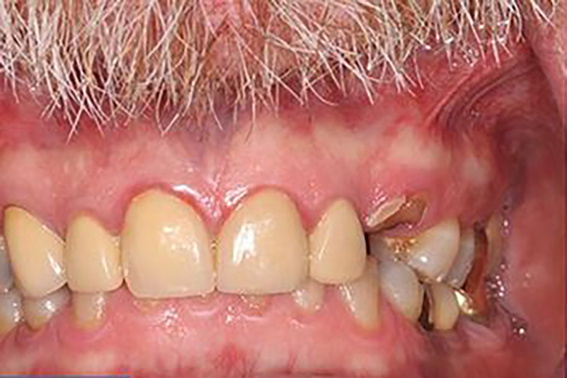 sugarland before and after dental treatment