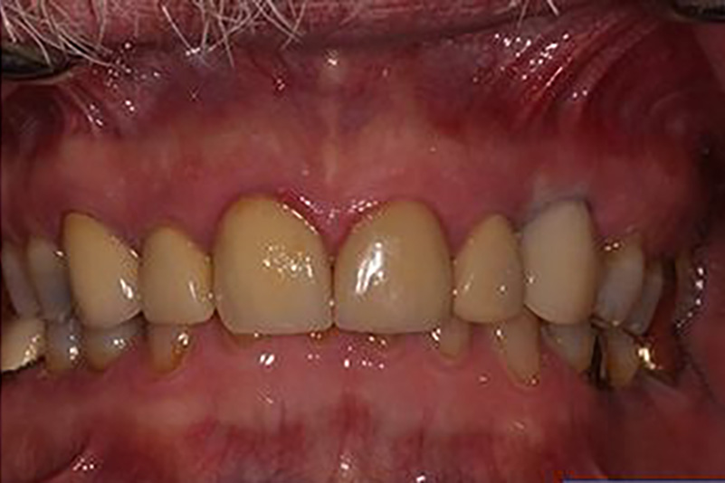 sugarland before and after dental treatment