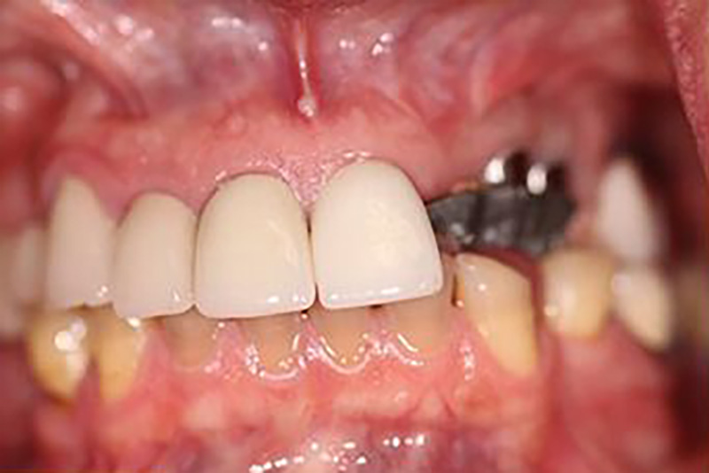 sugarland before and after dental treatment