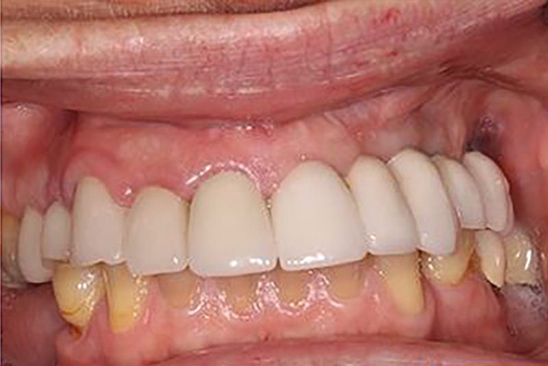 sugarland before and after dental treatment