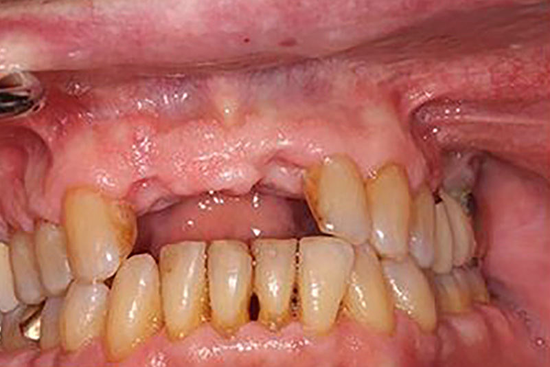 sugarland before and after dental treatment