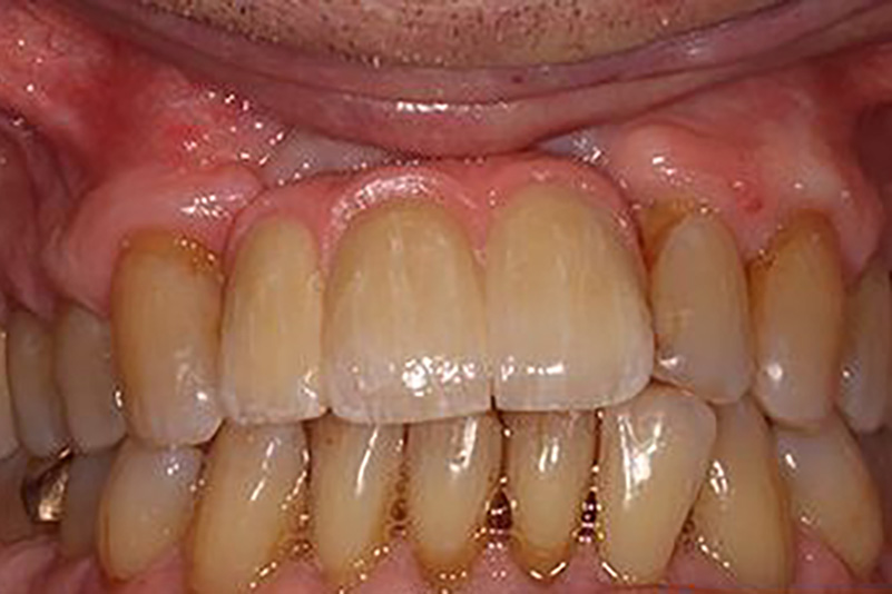sugarland before and after dental treatment
