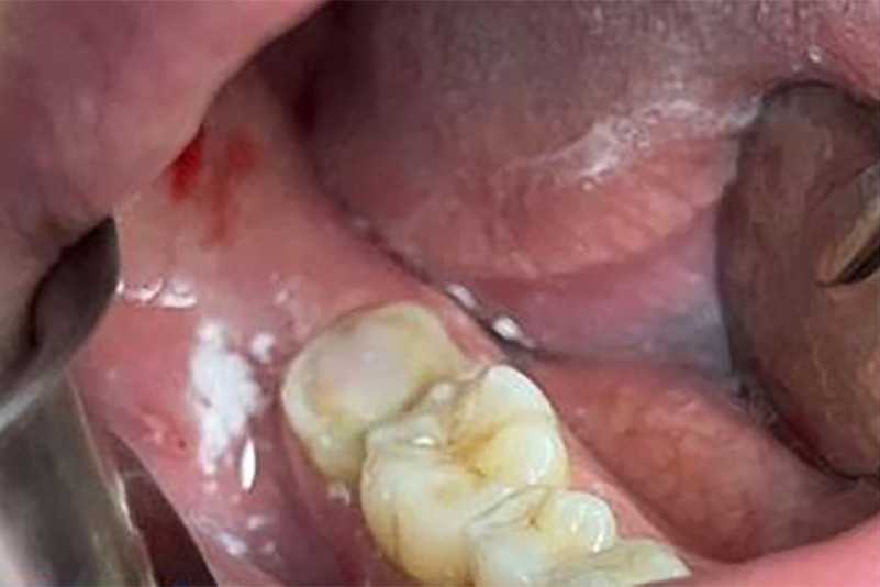 sugarland before and after dental treatment