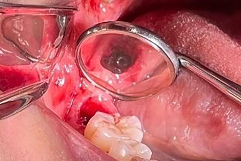 sugarland before and after dental treatment