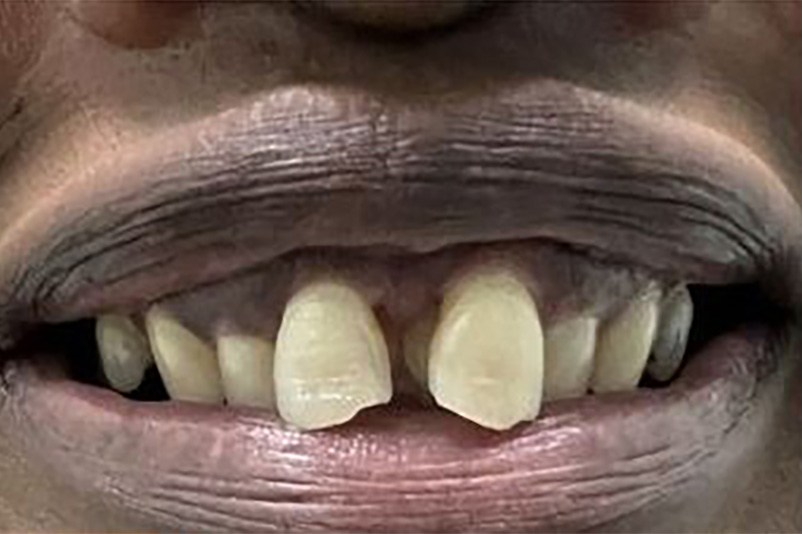 sugarland before and after dental treatment