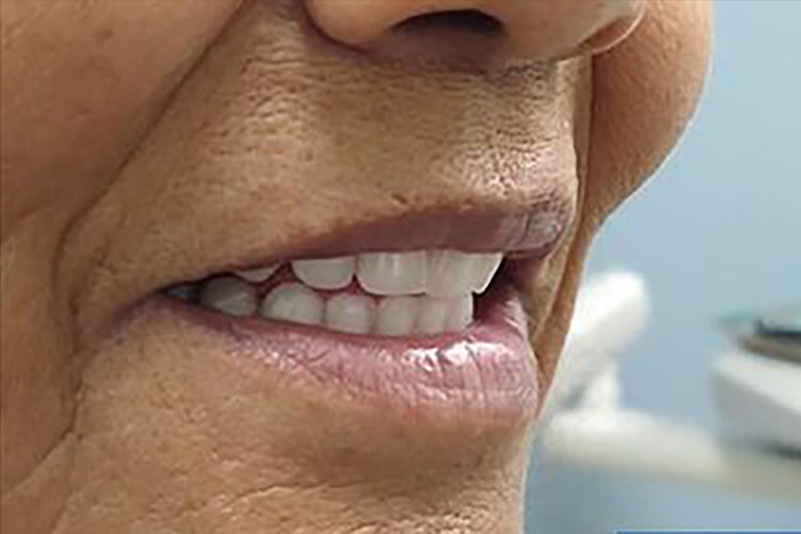 sugarland before and after dental treatment